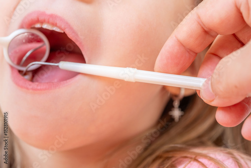 dentist, doctor examines oral cavity of small patient, uses mouth mirror, closeup baby teeth child, concept pediatric dentistry, dental treatment, correction of occlusion, oral care, caries prevention