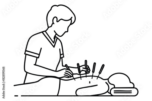 Therapist Applying Acupuncture Needles to Patient s Back