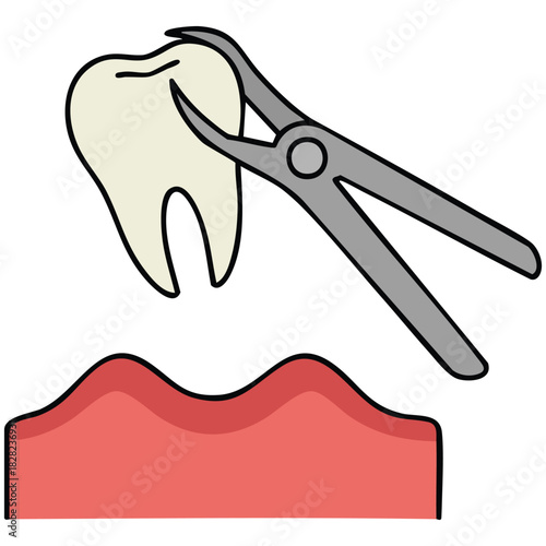 Tooth extraction with forceps dental implant vector