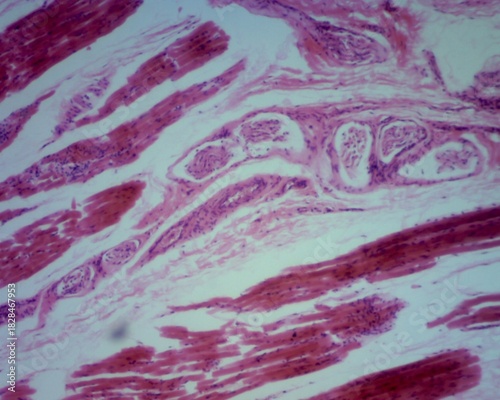 Microscopic observation of human epidermal sweat gland sections