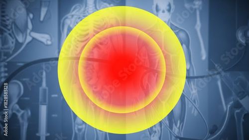 Radiating pain area highlighted in red and yellow over a skeletal body illustration background