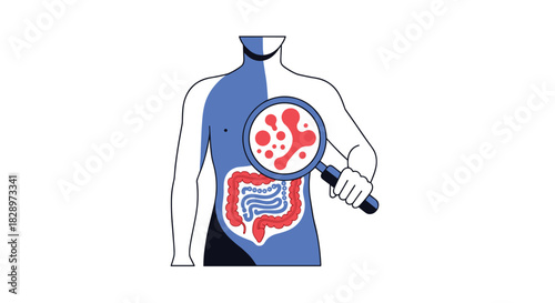 Medical illustration showing a doctor examining the human intestines with a magnifying glass to check for gut health and bacteria.