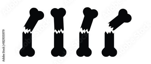 Detailed anatomy and types of bone fractures infographic for medical and healthcare design.