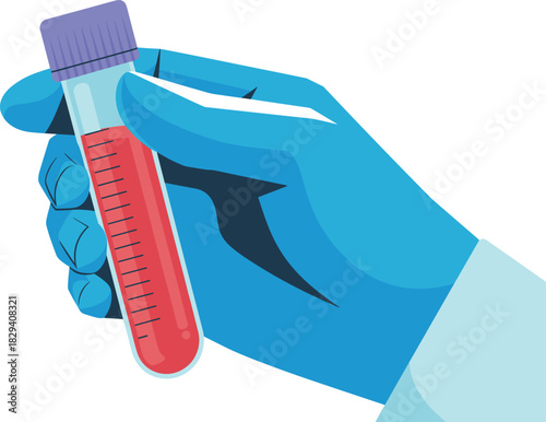 Flat Design Vector of Gloved Hand Holding Blood Test Tube with Measurement Scale