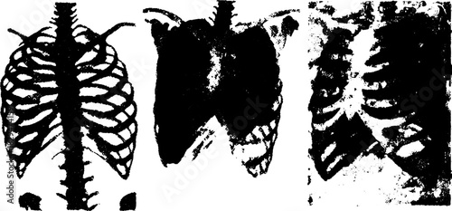 Skeleton ribs in a black and white x-ray style. Medical illustration featuring detailed anatomy in a simple vector format.