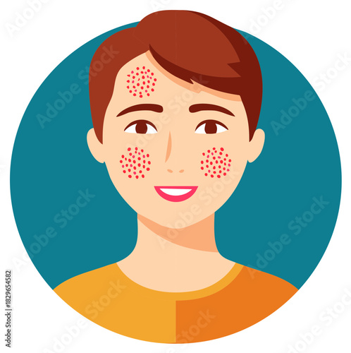 Young person with facial skin irritation and redness shown on the left side of their face