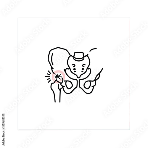 Human hip joint pain and injury illustration, medical line art diagram showing discomfort in the pelvic region.