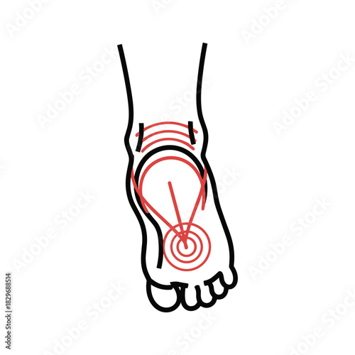 Detailed human foot and ankle pain illustration, highlighting discomfort zones, injury, or medical condition.