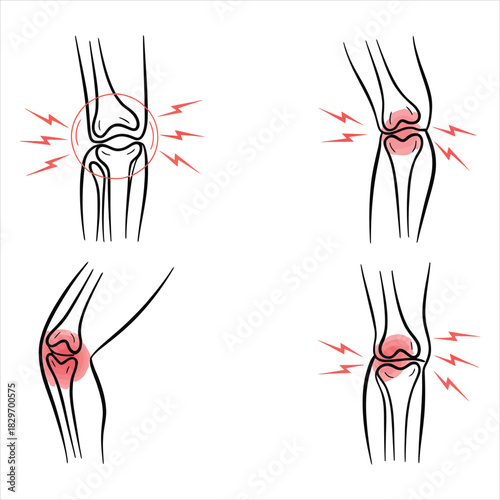 Outlined knee joints depicted with pain indicators portray musculoskeletal discomfort on white background