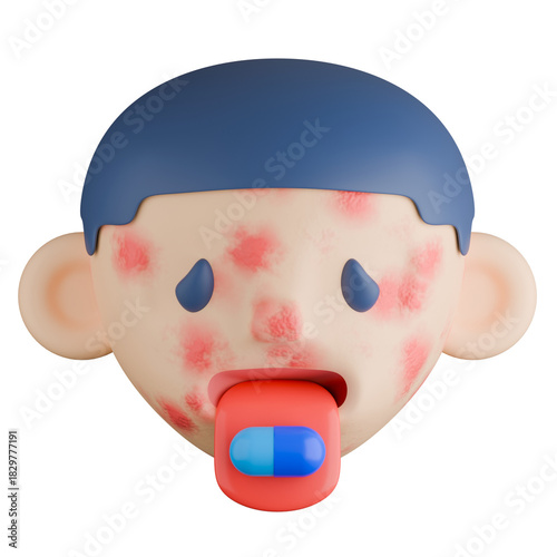 3D medical illustration of man face with a red rash and a capsule on the tongue, representing a severe adverse drug reaction or drug allergy.