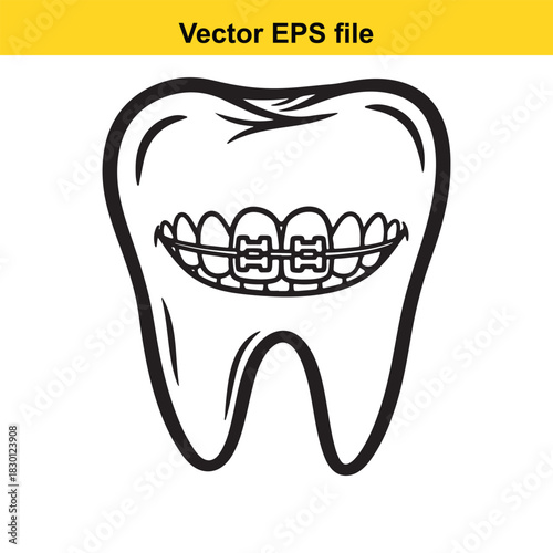 Outline vector illustration of a human molar tooth with dental braces attached to correct alignment, isolated on white background