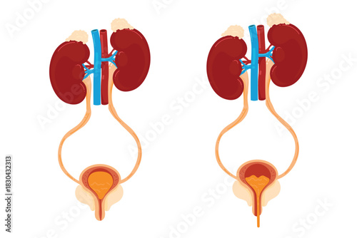 Human Urinary System Anatomy Set. Vector illustration of kidneys and bladder filling and emptying. Micturition process comparison.