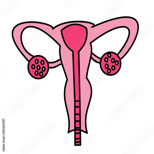 polycystic ovary syndrome ovaries with many cysts in both ovaries disease female minimalist color .eps