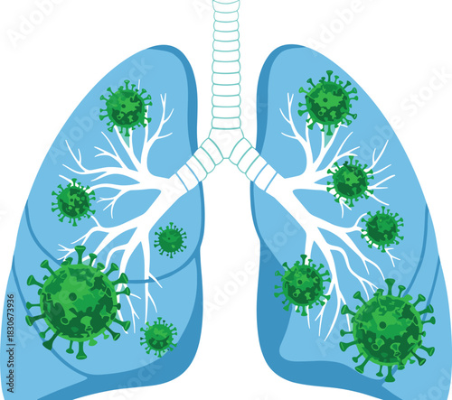 Lungs Infected with Coronavirus Vector,Disease Diagram, Virus Attacking Respiratory System Illustration, Medical Biology Graphic