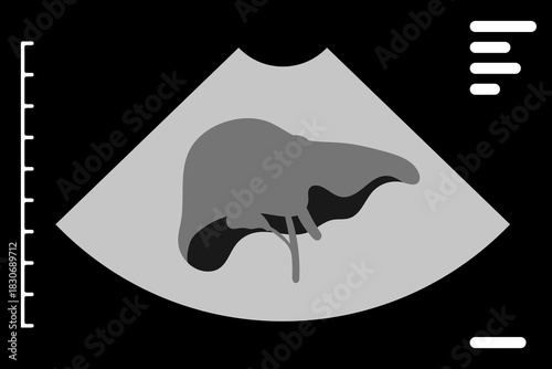 Ultrasound showing liver on medical monitor