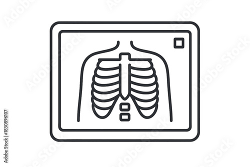 Medical -ray image of human chest showing rib cage and sternum on a diagnostic screen