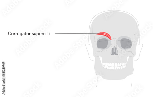 Corrugator supercilii - Human facial muscle shown in anatomy chart, responsible for drawing eyebrows medially and downward, associated with frowning, medical reference, educational diagram