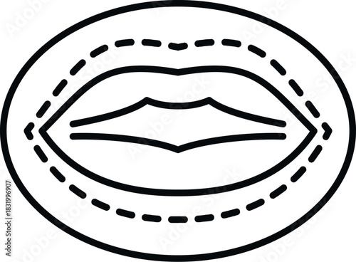 Lips with dashed lines around the outline, representing a cosmetic procedure