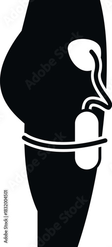 Human leg showing external urinary catheter providing incontinence care