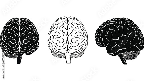 Three brain illustrations in black and white from different angles
