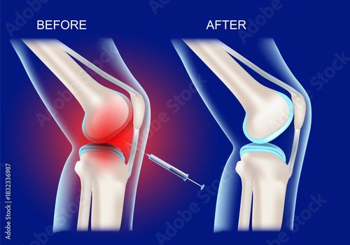 Knee pain treatment. Before and after therapy