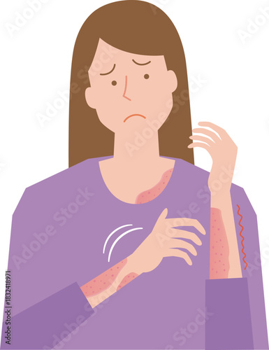 肌のかゆみに悩む女性