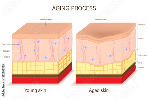 Comparison of young skin and aged skin. Facial skin problems. Aging process. Vector for advertising about beauty and medical treatment.