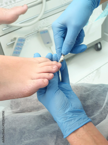A podologist properly trims a patient's nails using nail clippers.
