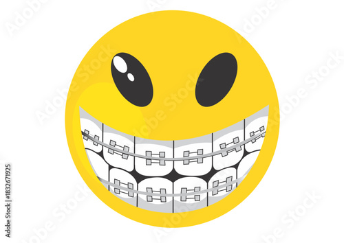 A yellow smiley face with black eyes and a wide smile showing teeth with metal braces on them clearly