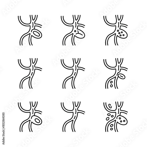 Illustrations depict various stages of vascular disease and blood vessel blockages.