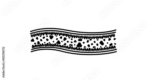 Illustration of a Blood Vessel with Plaque Buildup.