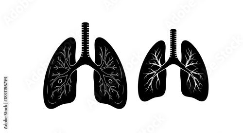 Lungs Illustration Healthy vs Diseased Anatomical Comparison.