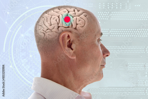 senior man with transparent skull showing brain activity, red dot neural focus, neuroscience artificial intelligence connection human brain function, futuristic circuit board background technology