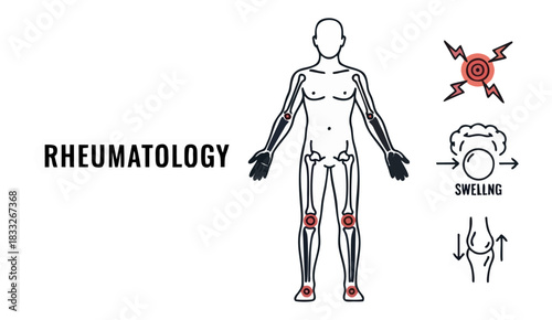 Medical line art illustration detailing the concept of Rheumatology.