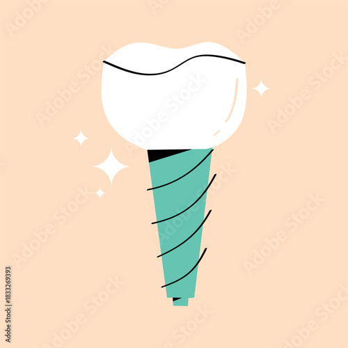 Clean vector illustration of a dental implant with a bright crown. Modern design for dentistry materials, clinics, oral health education, and professional medical content