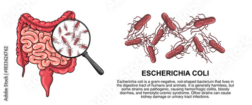 Illustration of escherichia bacteria. e.coli, bad bacteria in the human body. dangerous micro organisms, vector illustration for medical posters, treatment, or clinics.