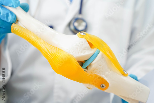 Asian doctor holding spinal nerve and bone model, Lumbar spine displaced herniated disc fragment for treatment medical in the orthopedic department.