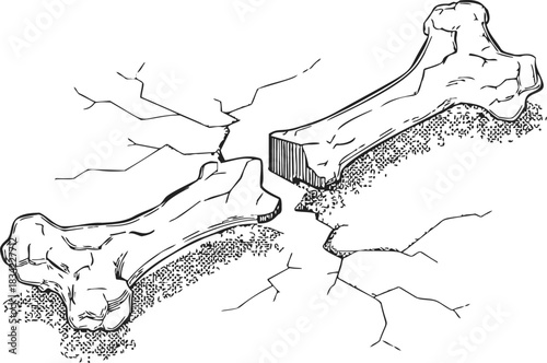 Broken bone sketch, hand drawn style, detailed fracture with cracks. Vector illustration