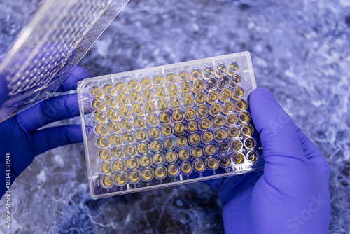 A scientist holds an open immunology plate with a cell culture in liquid against a blue workbench.