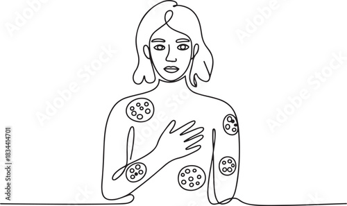 A woman with multiple psoriasis rashes all over her body. International Psoriasis Day. One line drawing for different uses. one line Icon drawing