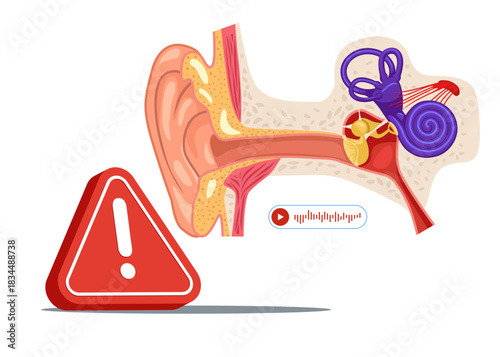 Human ear with exclamation attention sign. Ear Pain, Tinnitus, Otitis or Deaf. Human Ear Anatomy Cross Section View with Cochlea and Parts. Flat vector illustration
