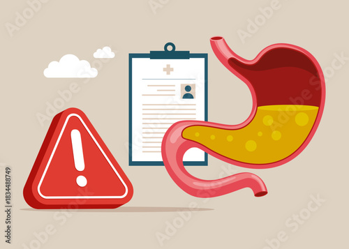 Human stomach full of gastric acid in cut view with exclamation attention sign. Gastroesophageal reflux disease. Problem. Flat vector illustration