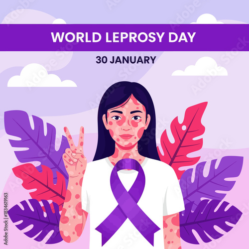 Illustration of a girl showing skin patches for World Leprosy Day awareness, promoting compassion, inclusion, and global support on January 30.