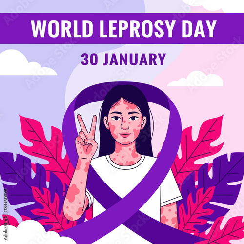 Illustration of a girl showing skin patches for World Leprosy Day awareness, promoting compassion, inclusion, and global support on January 30.