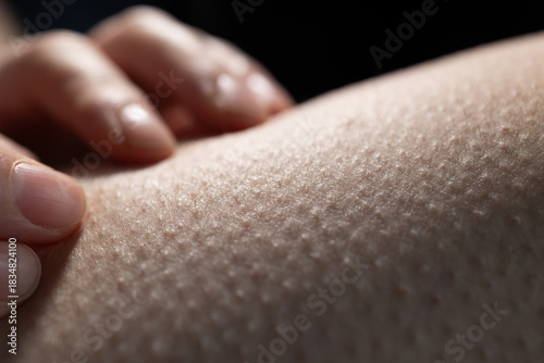 A hand lightly touches skin with raised bumps as a reaction to cold air. The surface appears smooth but has distinct goosebumps all over. This scene captures a moment of physical response.