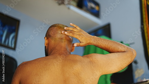 Close-up image of a patient gently applying healing cream to the donor area on the scalp three days after a hair transplant.