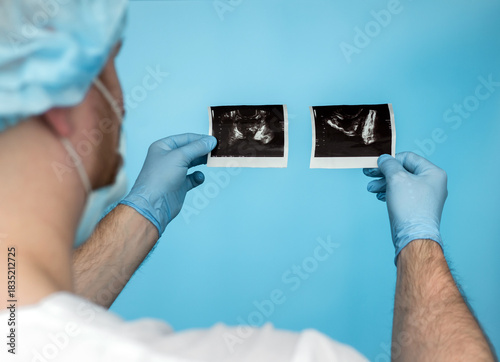 The doctor examines the ultrasound of prostate adenoma in a man. A urologist studies a disease of the genitourinary system, impotence in a man. Men's health concept. Urination problems scan.