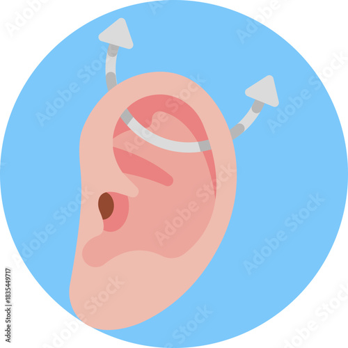 A barbell piercing that connects two holes on the upper ear cartilage.