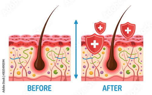 Hair follicle health comparison before and after treatment showing protective shield action for healthy growth and scalp care