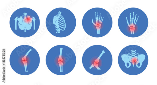 A comprehensive vector illustration set featuring various human joints and bones, highlighting areas of pain or inflammation for medical and anatomical studies.